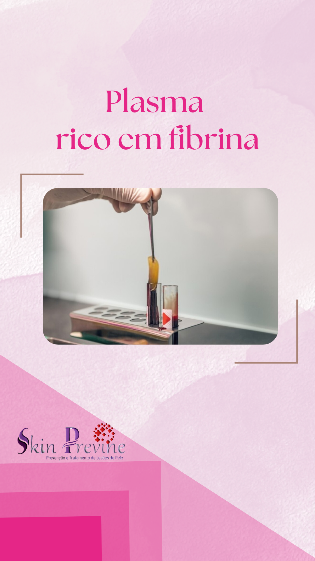 Cópia de Laser terapia (1)